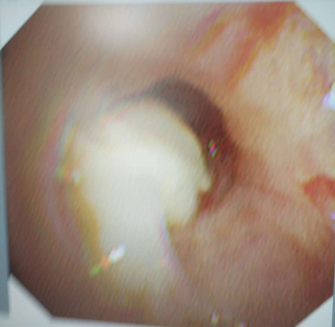fd4a215325b6d3ff9553aa94011b1088.png