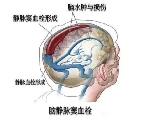 6a25a28c9ac3b095cc865c8b5cf9f86.jpg